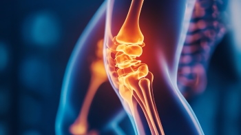 Knee Joint Treatment - DIAGNOSIS 28xJPEG, 7xPNG