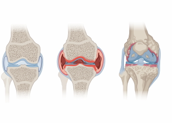 Knee Joint Treatment - DIAGNOSIS 28xJPEG, 7xPNG