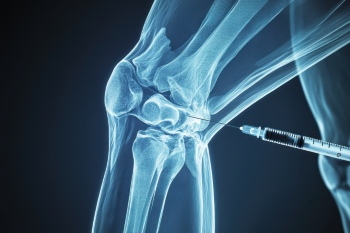 Knee Joint Treatment - DIAGNOSIS 28xJPEG, 7xPNG