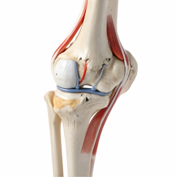 Knee Joint Treatment - DIAGNOSIS 28xJPEG, 7xPNG