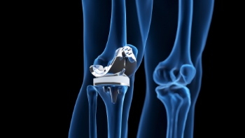 Knee Joint Treatment - DIAGNOSIS 28xJPEG, 7xPNG