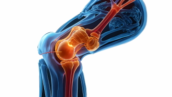 Knee Joint Treatment - DIAGNOSIS 28xJPEG, 7xPNG