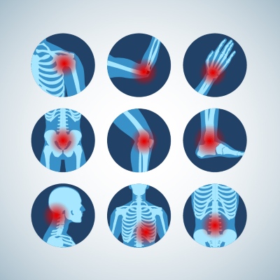 Knee Joint Treatment VECTORS 26xAI