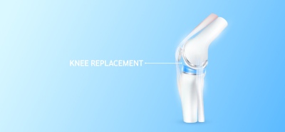 Knee Joint Treatment VECTORS 26xAI