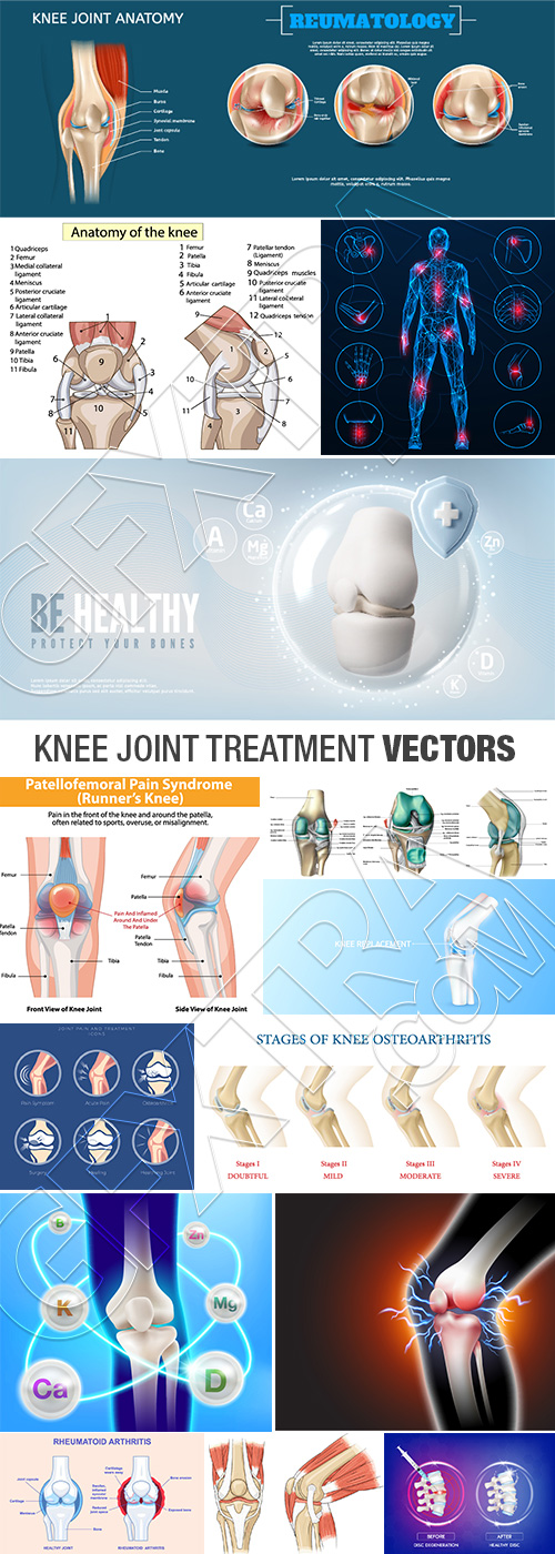 Knee Joint Treatment VECTORS 26xAI