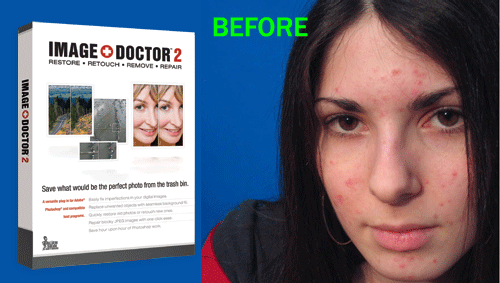 Image Doctor v2.1.1.1079 for Photoshop