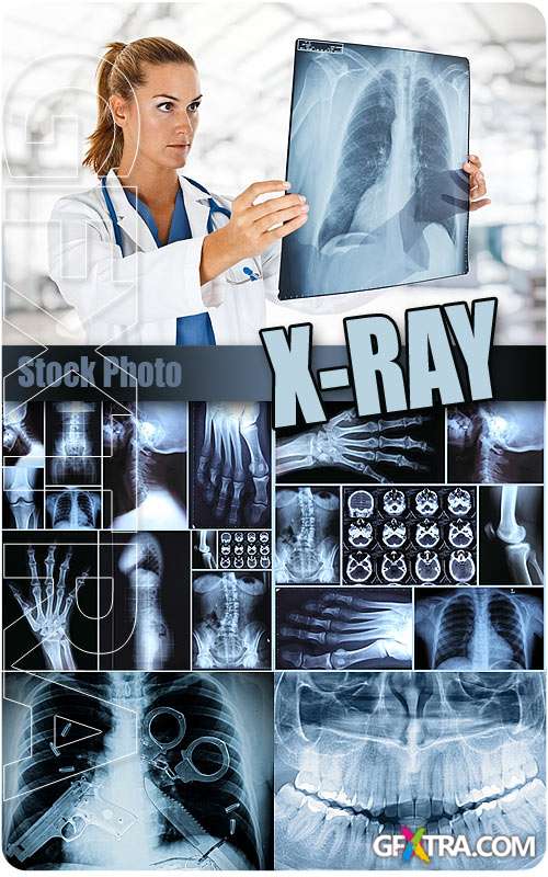 X-ray - UHQ Stock Photo