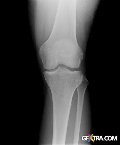 Human Anatomy Great Collection 175xJPG