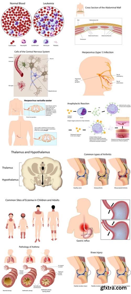Anatomy and Ilness Mass Collection 333xEPS