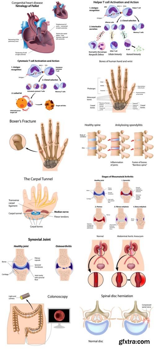 Anatomy and Ilness Mass Collection 333xEPS