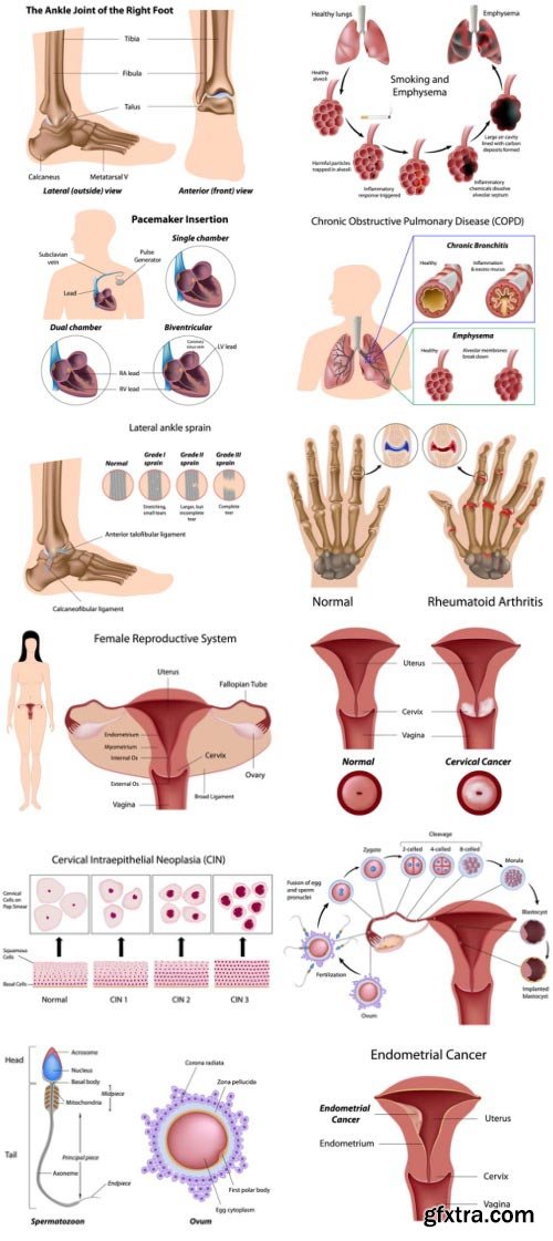 Anatomy and Ilness Mass Collection 333xEPS