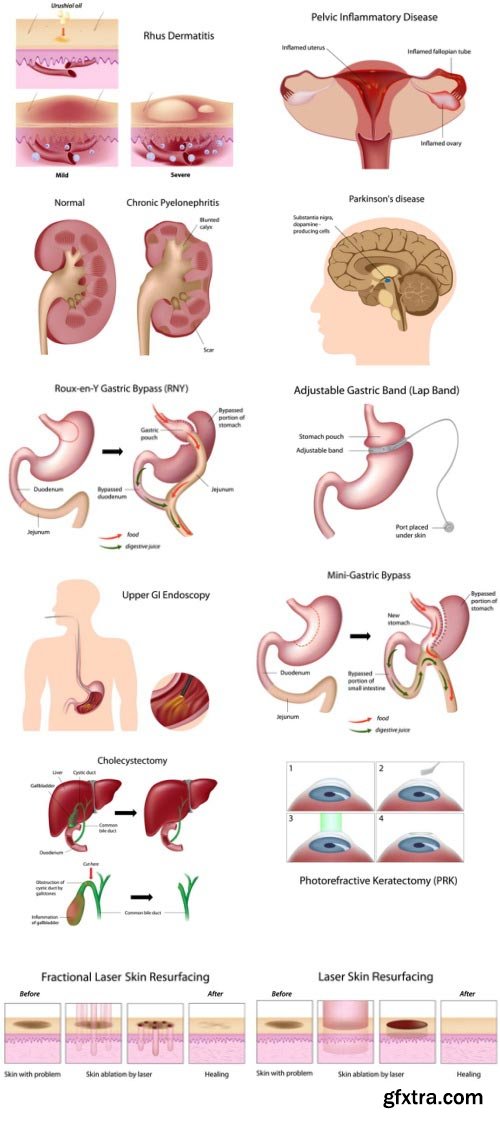 Anatomy and Ilness Mass Collection 333xEPS
