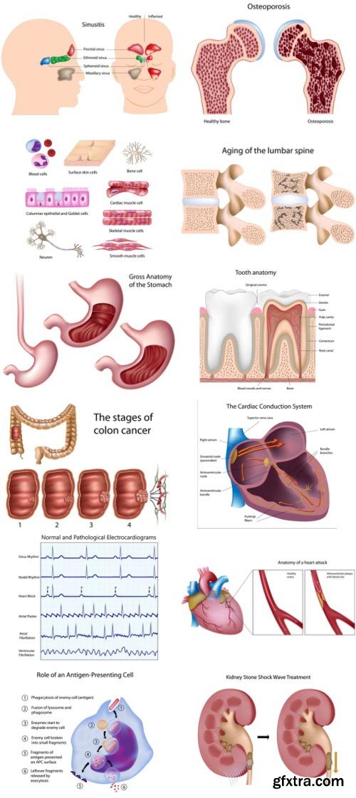 Anatomy and Ilness Mass Collection 333xEPS