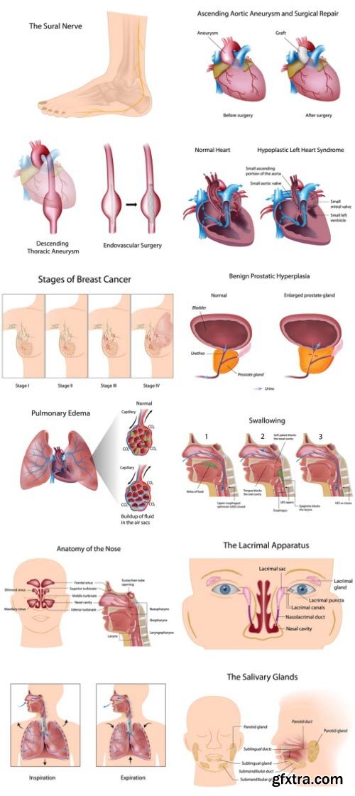 Anatomy and Ilness Mass Collection 333xEPS