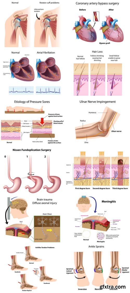 Anatomy and Ilness Mass Collection 333xEPS