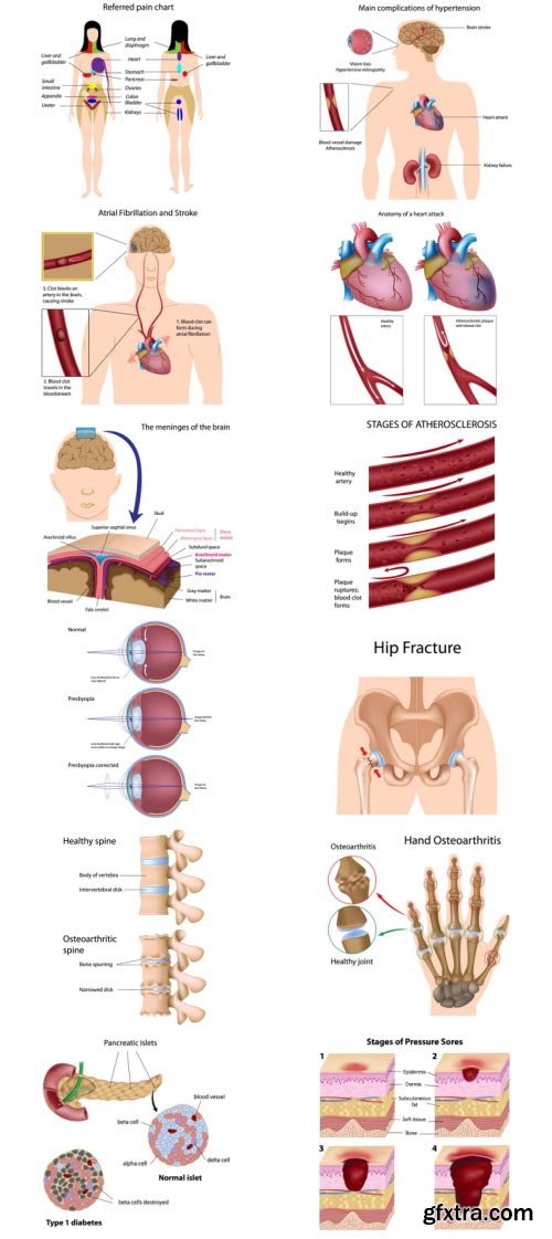 Anatomy and Ilness Mass Collection 333xEPS
