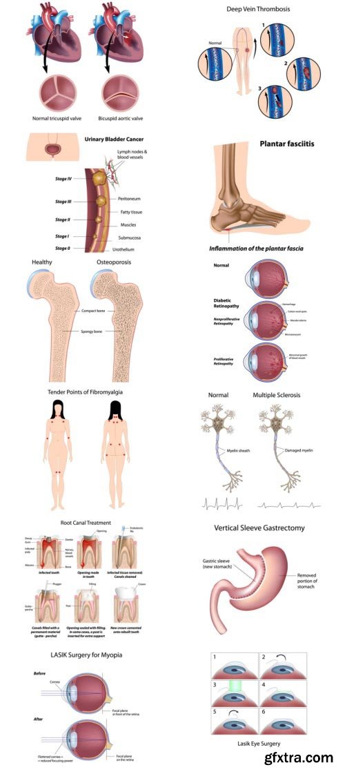 Anatomy and Ilness Mass Collection 333xEPS