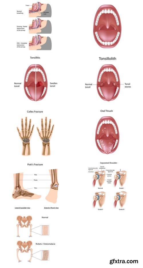 Anatomy and Ilness Mass Collection 333xEPS