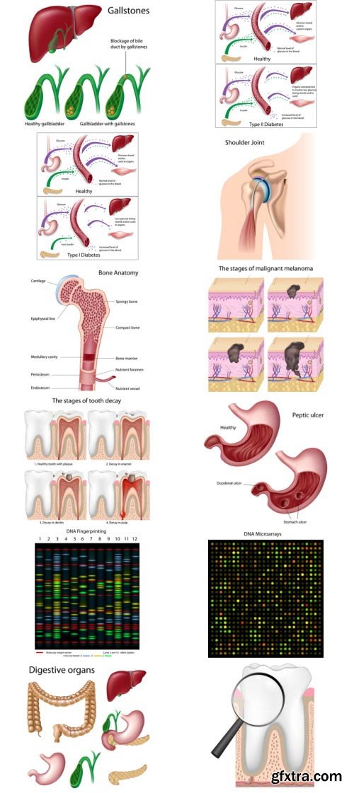 Anatomy and Ilness Mass Collection 333xEPS