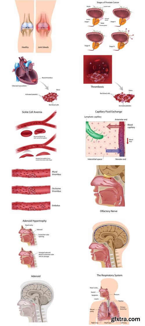 Anatomy and Ilness Mass Collection 333xEPS