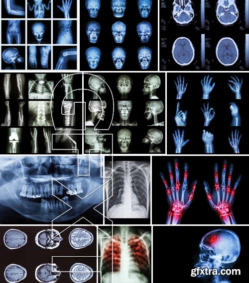 Stock Photos - X-ray, Roentgenogram, 25xJPG Stock Photos - X-ray, Roentgenogram, 25xJPG