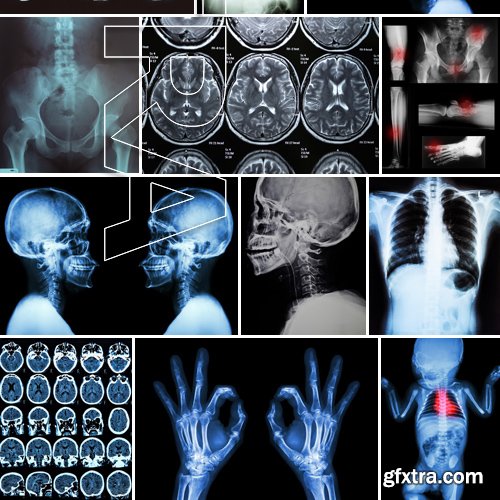 Stock Photos - X-ray, Roentgenogram, 25xJPG Stock Photos - X-ray, Roentgenogram, 25xJPG
