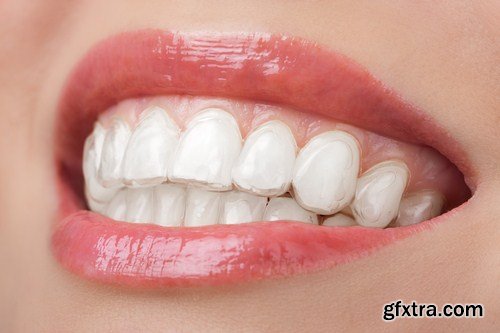 teeth with whitening tray 7X JPEG