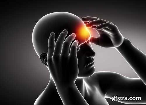 Collection of headache disorder of body disease 25 HQ Jpeg