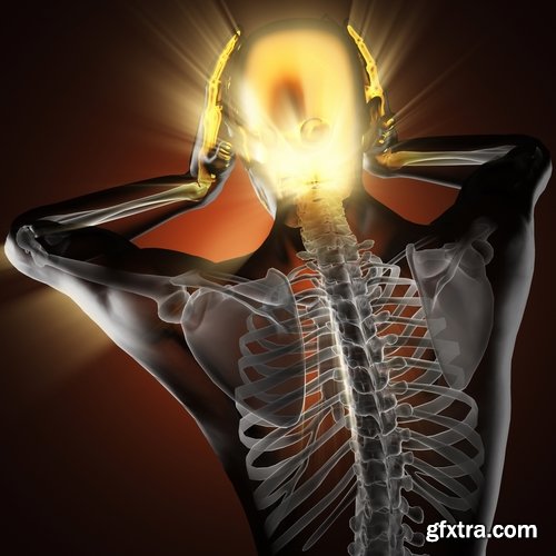 Collection of headache disorder of body disease 25 HQ Jpeg