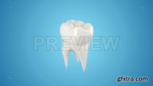 Tooth Loop Pack 133552
