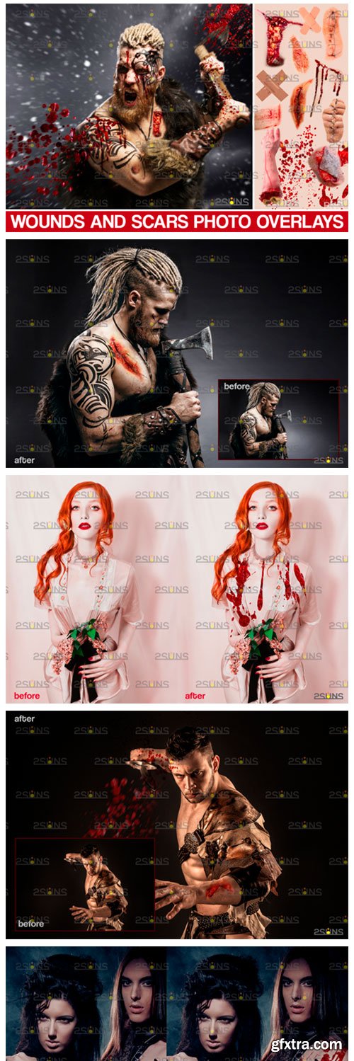 Wounds and Scars, Blood Splatter Overlay 6180431 Wounds and Scars, Blood Splatter Overlay 6180431