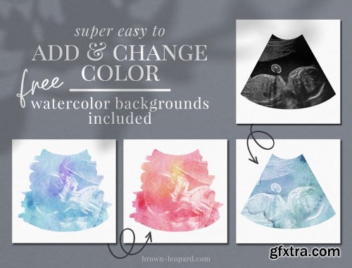 CreativeMarket - Watercolor ultrasound photomasks 5928707