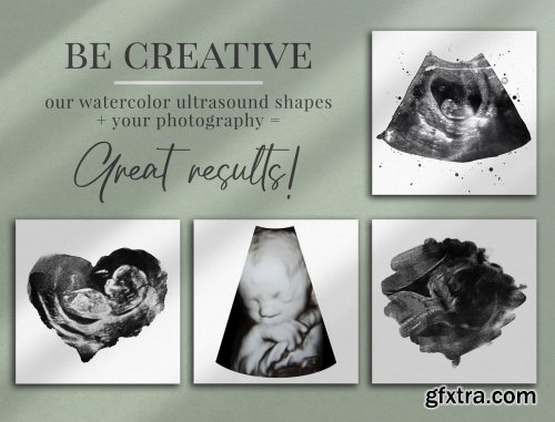 CreativeMarket - Watercolor ultrasound photomasks 5928707