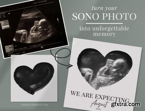 CreativeMarket - Watercolor ultrasound photomasks 5928707