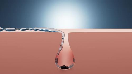 Videohive - 3d animation of Skin Layer Water deep Cleaning dirty skin - 43190631 - 43190631