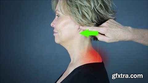 Correcting Forward Head Posture: Relieve Pain and Headaches