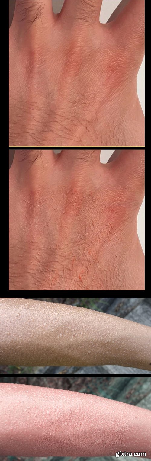 Skin Scratches Photoshop Brushes Pack Skin Scratches Photoshop Brushes Pack