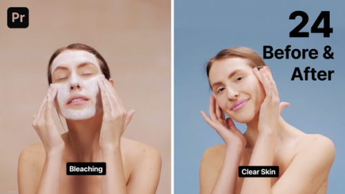 Before and After - 51376304