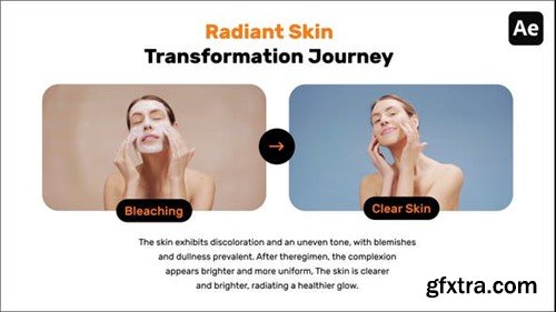 Videohive Before After Social Media Videos 52838652 Videohive Before After Social Media Videos 52838652