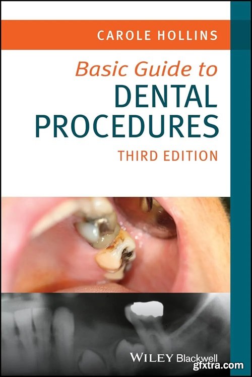 Basic Guide to Dental Procedures, 3rd Edition
