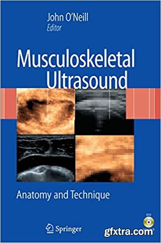 Musculoskeletal Ultrasound: Anatomy and Technique