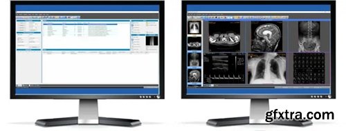 Sante PACS Server PG 4.2.4