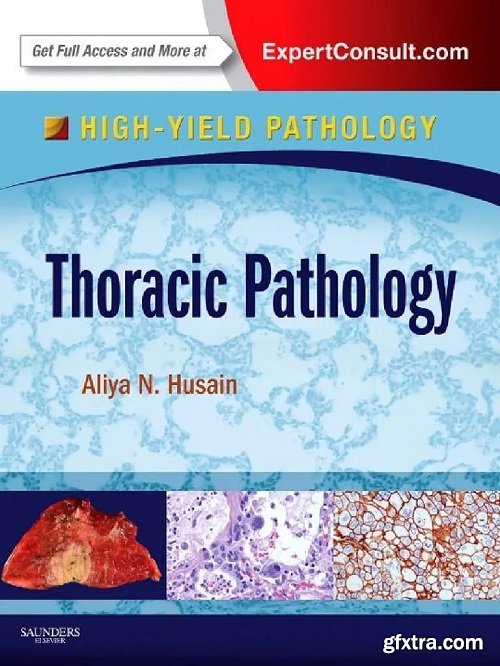 Thoracic Pathology: A Volume in the High Yield Pathology Series 1st Edition