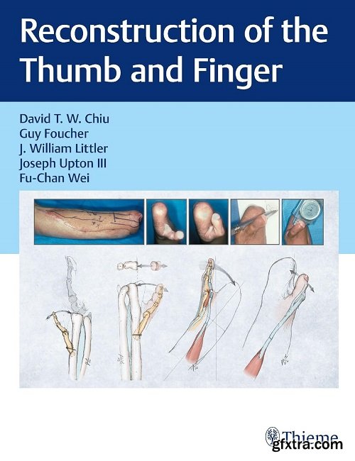 Reconstruction of the Thumb and Finger