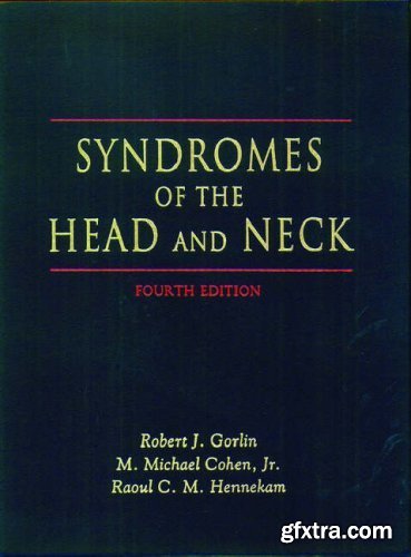 Syndromes of the Head and Neck