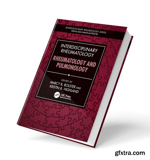 Interdisciplinary Rheumatology: Rheumatology and Pulmonology
