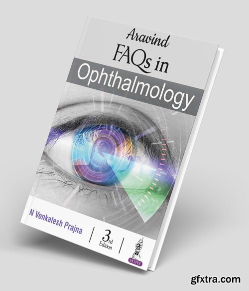 Aravind FAQs in Ophthalmology