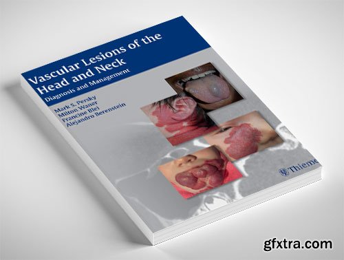 Vascular Lesions of the Head and Neck: Diagnosis and Management