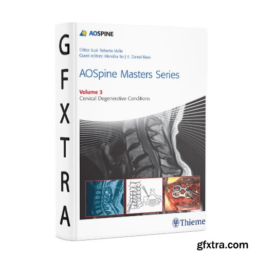 AOSpine Masters Series, Volume 3: Cervical Degenerative Conditions