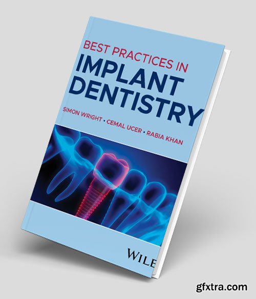 Best Practices in Implant Dentistry